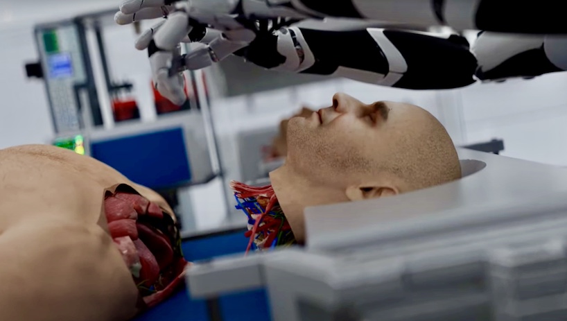 Head Transplant